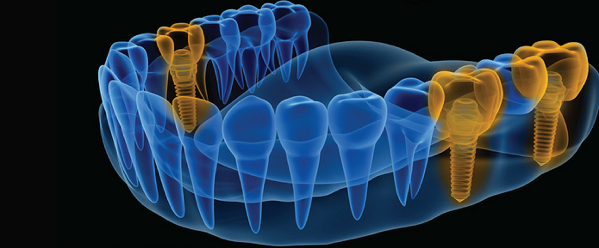 Digital Dentistry